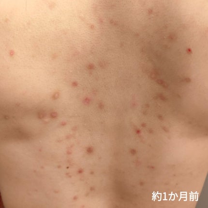 スムーススキンコントロール ボディスクラブ/ミュゼコスメ/ボディスクラブを使ったクチコミ(2枚目)