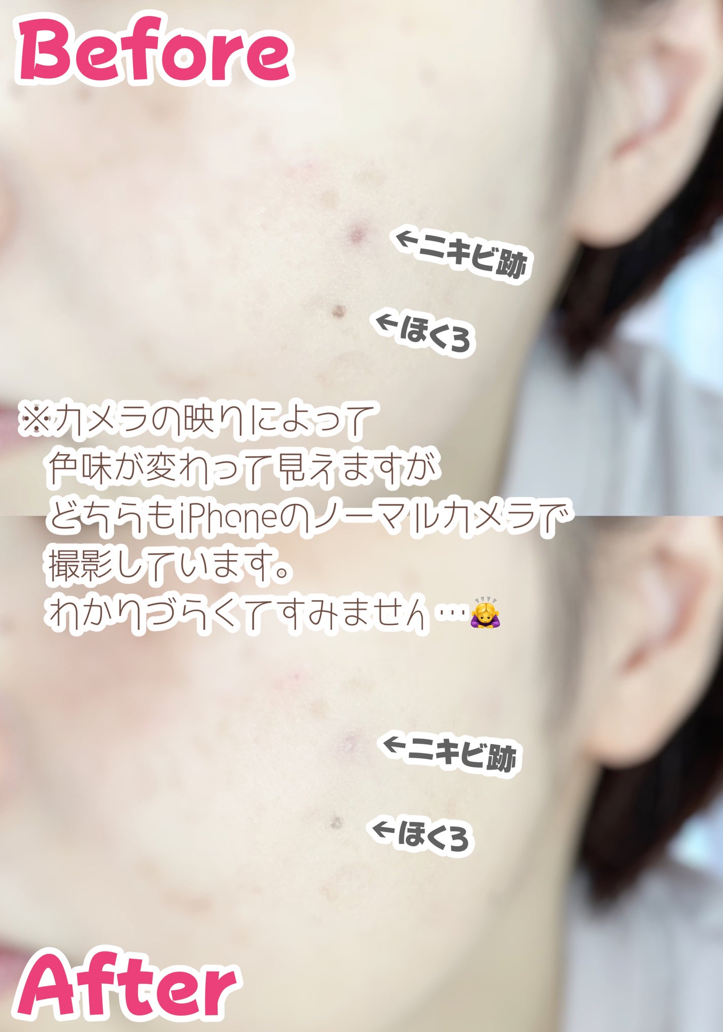 カバーパーフェクション コンシーラー ペンシル/the SAEM/ペンシルコンシーラーを使ったクチコミ(5枚目)