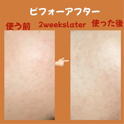 PDRNショット675/COSNORI/美容液を使ったクチコミ(4枚目)