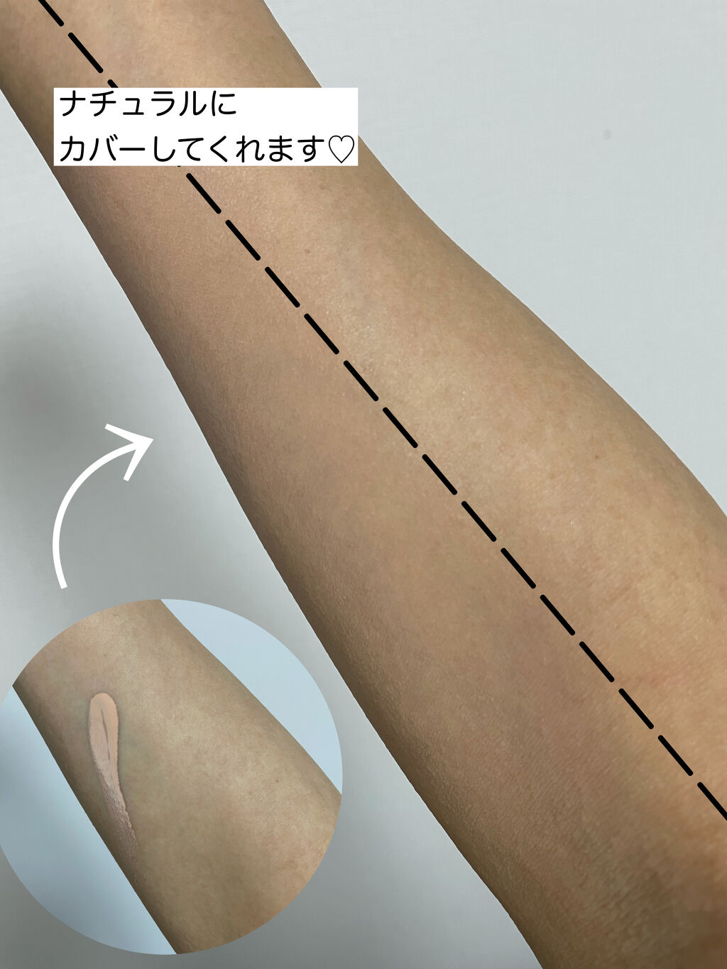 【旧】ディオールスキン フォーエヴァー フルイド グロウ/Dior/リキッドファンデーションを使ったクチコミ（2枚目）