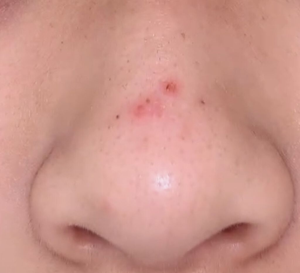 おうちdeエステ 肌をなめらかにする マッサージ洗顔ジェル/ビオレ/その他洗顔料を使ったクチコミ（2枚目）