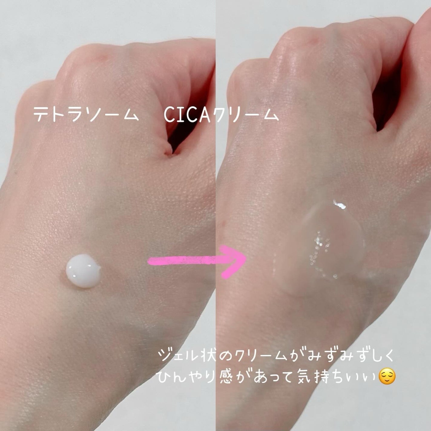 アピュー テトラソーム CICA化粧水/A’pieu/化粧水を使ったクチコミ(4枚目)