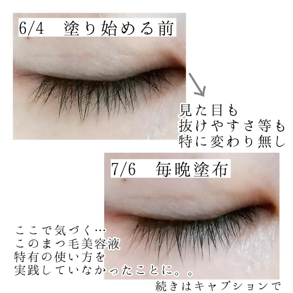 ダーマメディシナ まつげ栄養剤 /SAYCOS/その他スキンケアを使ったクチコミ（3枚目）
