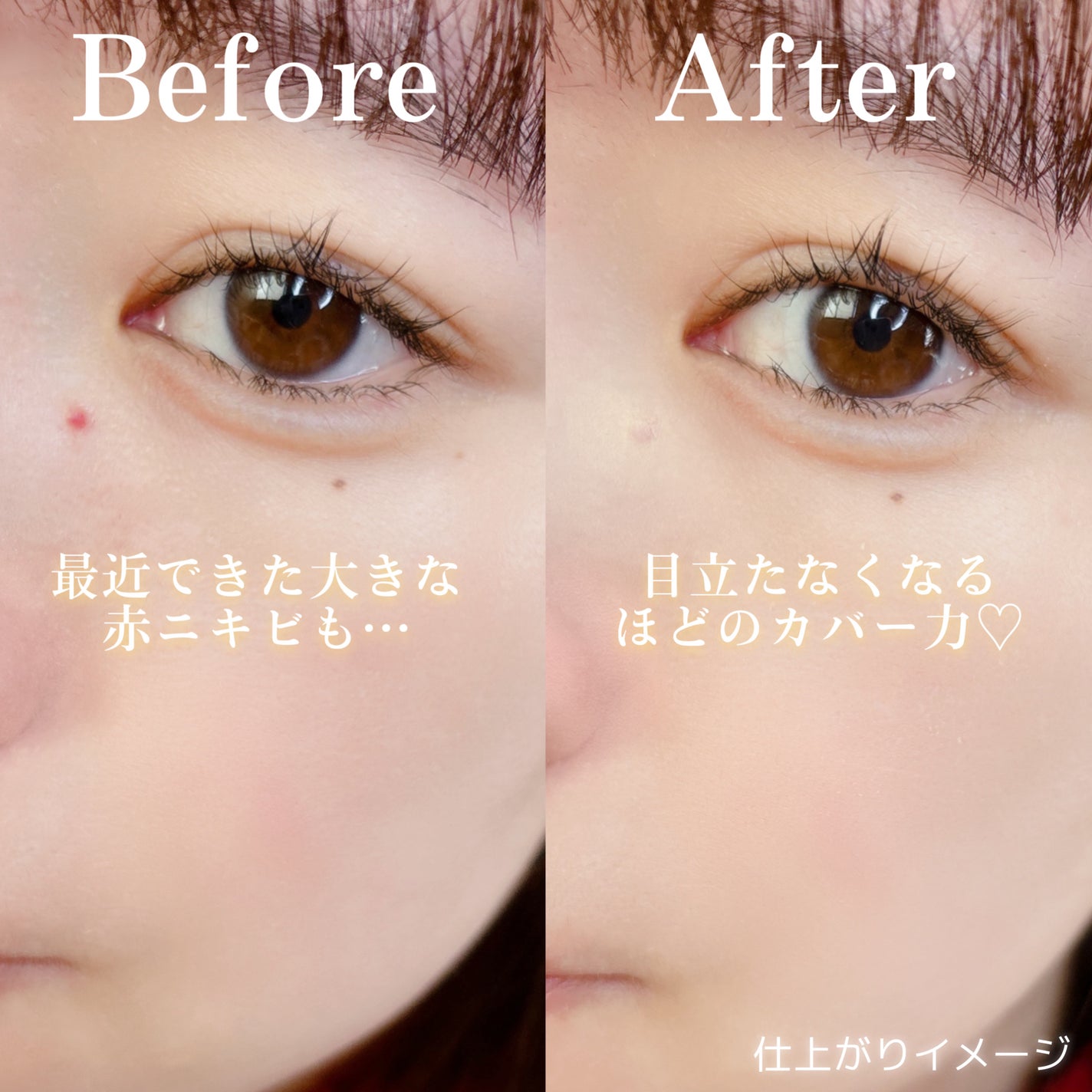 イプノス シーバムクリア リペアクリーム/ACSEINE/フェイスクリームを使ったクチコミ(4枚目)