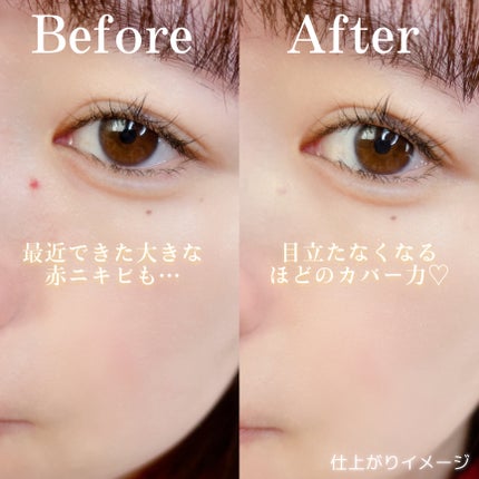 イプノス シーバムクリア リペアクリーム/ACSEINE/フェイスクリームを使ったクチコミ(4枚目)