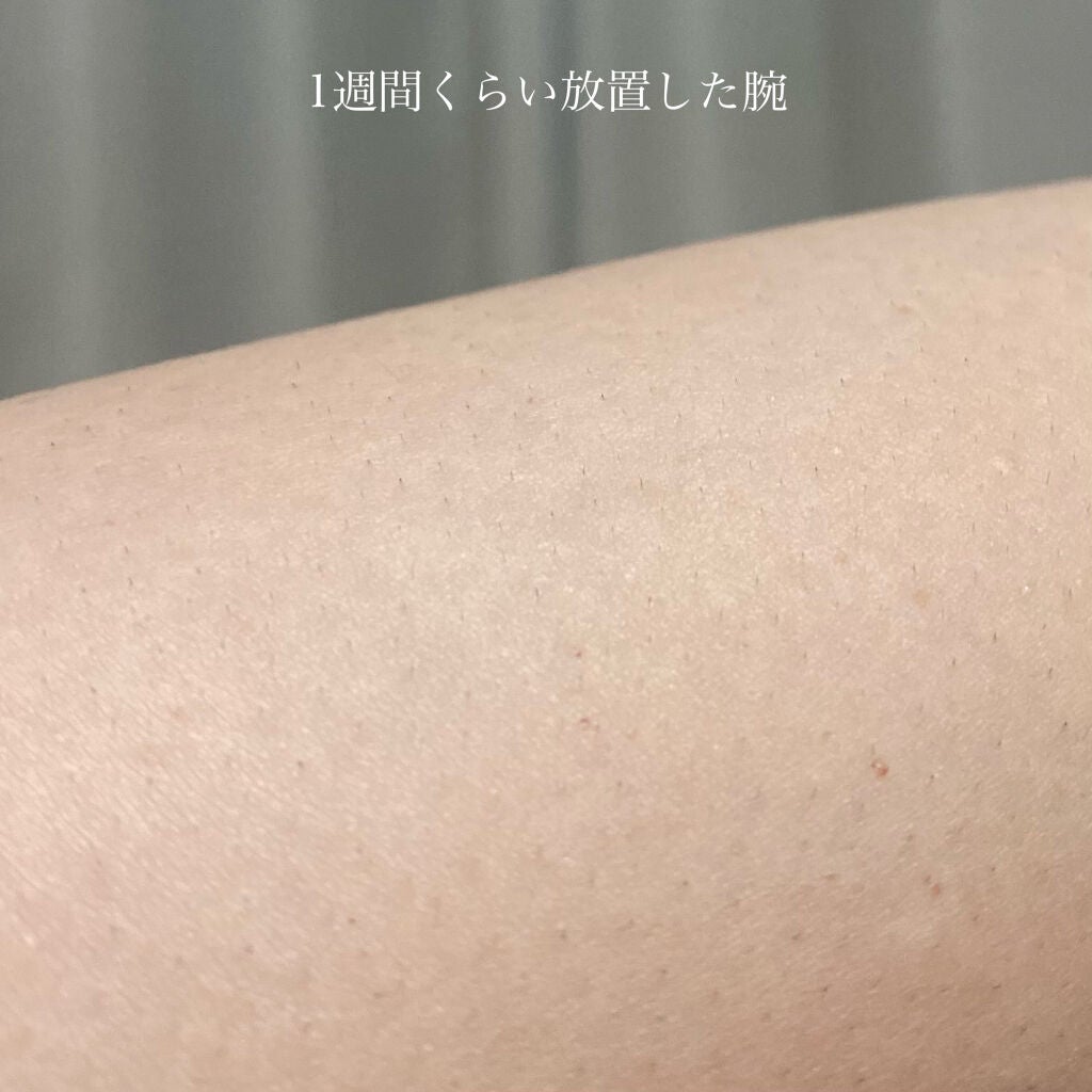 FASIZ607C IPL光脱毛器/FASIZ/家庭用脱毛器を使ったクチコミ(2枚目)