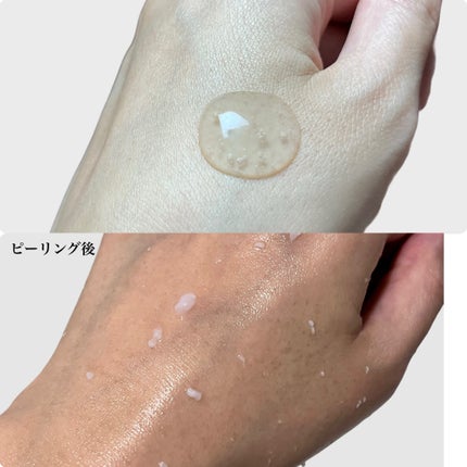 DETクリア ブライト&ピール ピーリングジェリー<ミックスフルーツの香り>/Detclear/ピーリングを使ったクチコミ(2枚目)