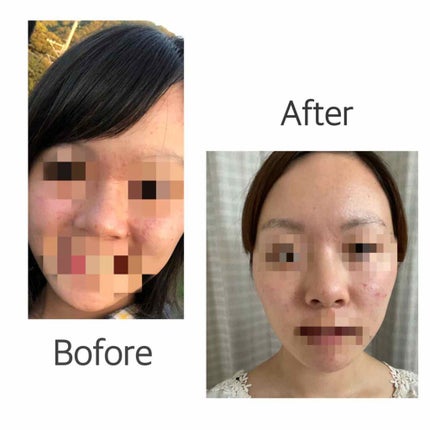 潤浸保湿 化粧水 II しっとり/キュレル/化粧水を使ったクチコミ(3枚目)