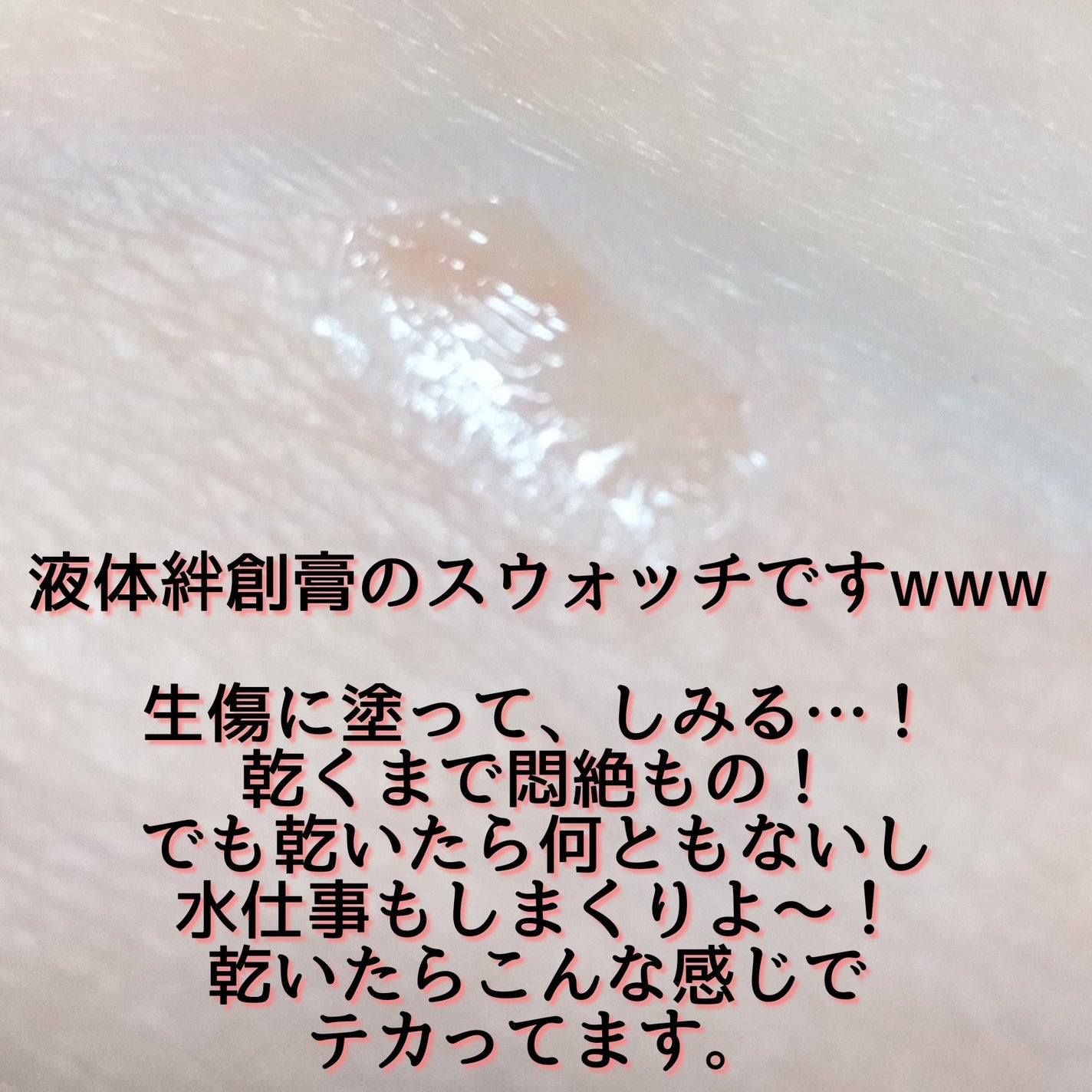 早く乾いてピッタリ保護消毒もできる液体ばんそうこう/ケアハート/その他を使ったクチコミ(7枚目)