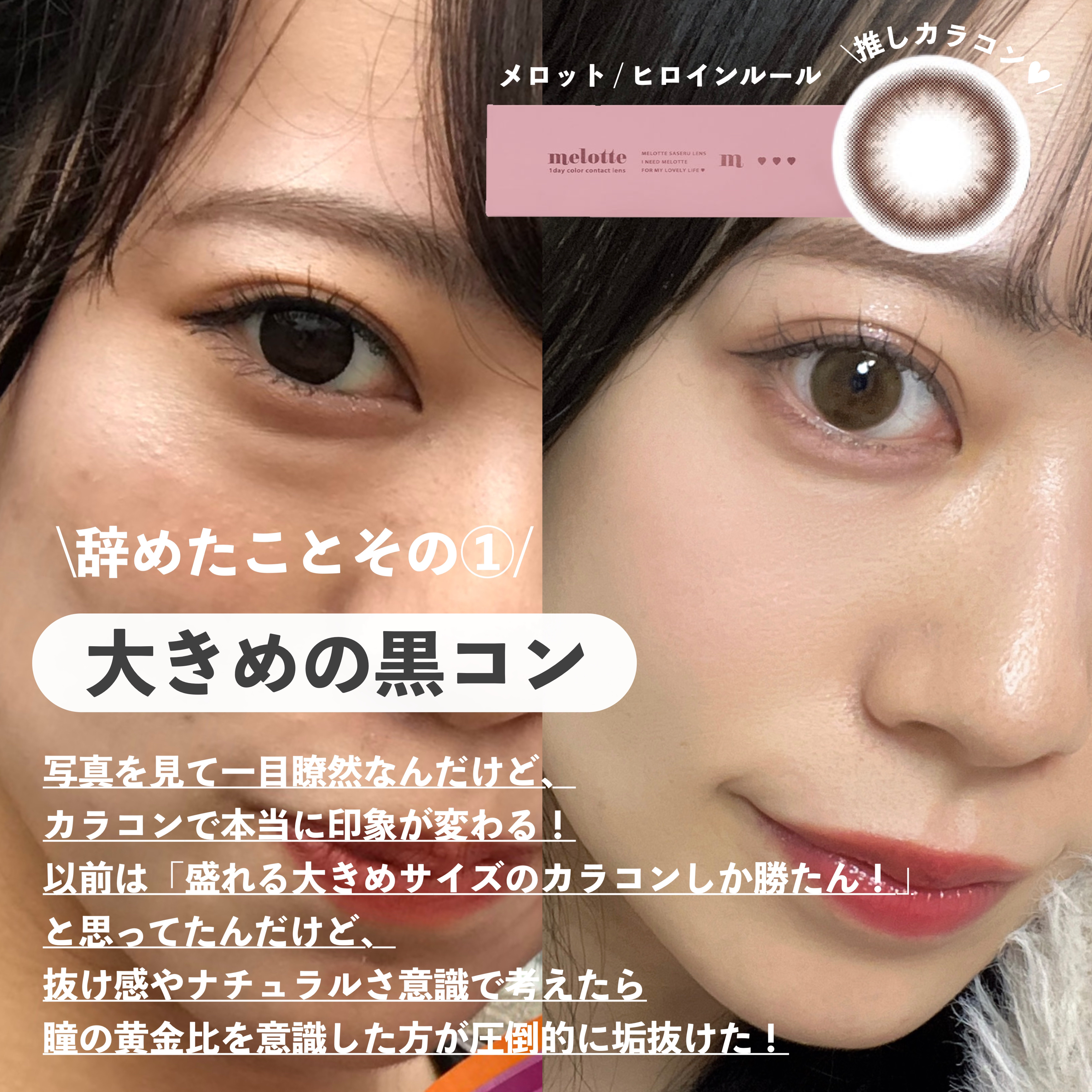  ホホバリップエッセンス/SIDMOOL/リップ美容液を使ったクチコミ（2枚目）