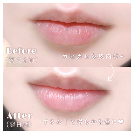 𝗹 𝘂 𝗶 のクチコミ「𓊆 人気なだけある⸜❤︎⸝ 𓊇
ティントを使うとわかるすごさ✨
𝐂𝐀𝐍𝐌𝐀𝐊𝐄のリップケアス.....」(3枚目)