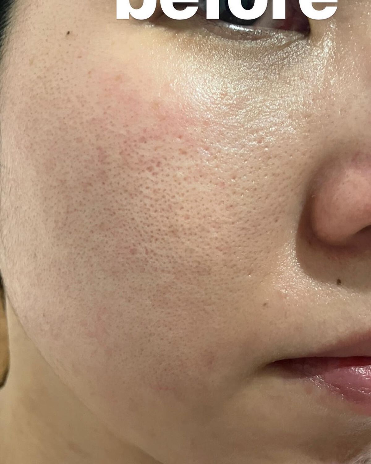 ちーひろ on LIPS 「InstagramでVTレッツリードルショット第2弾キャンペー..」(4枚目)