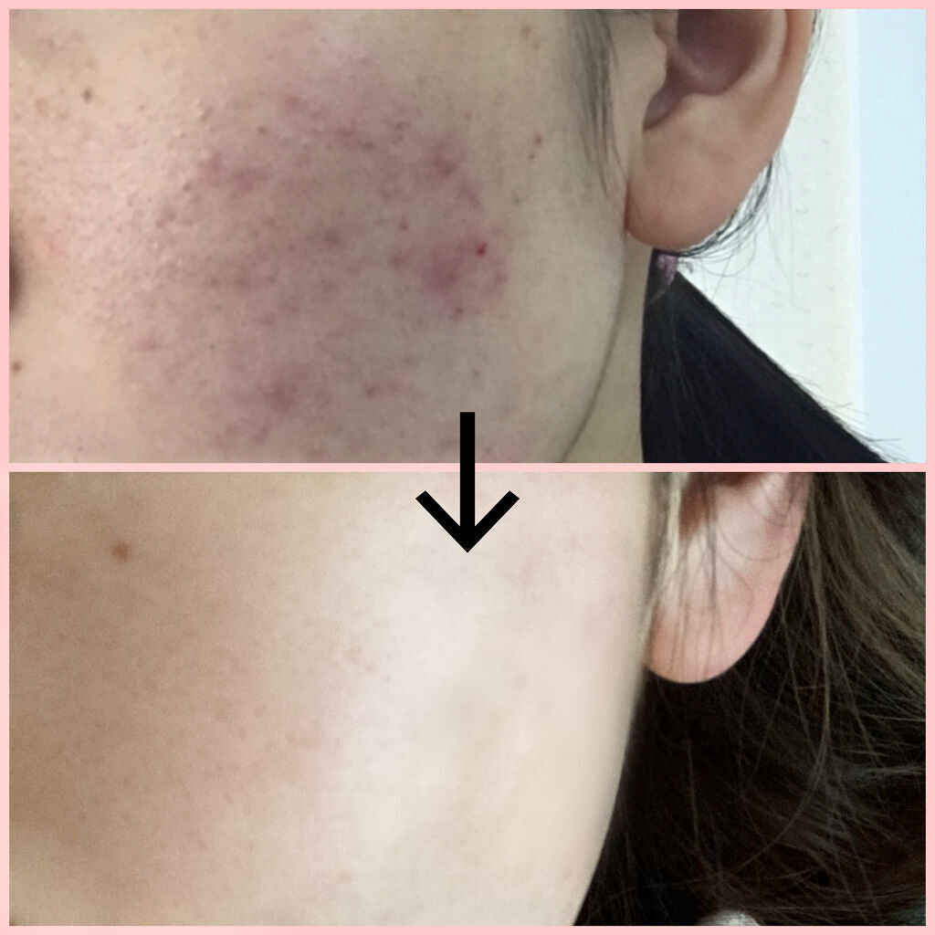 なめらか本舗 乳液 NA/なめらか本舗/乳液を使ったクチコミ（1枚目）