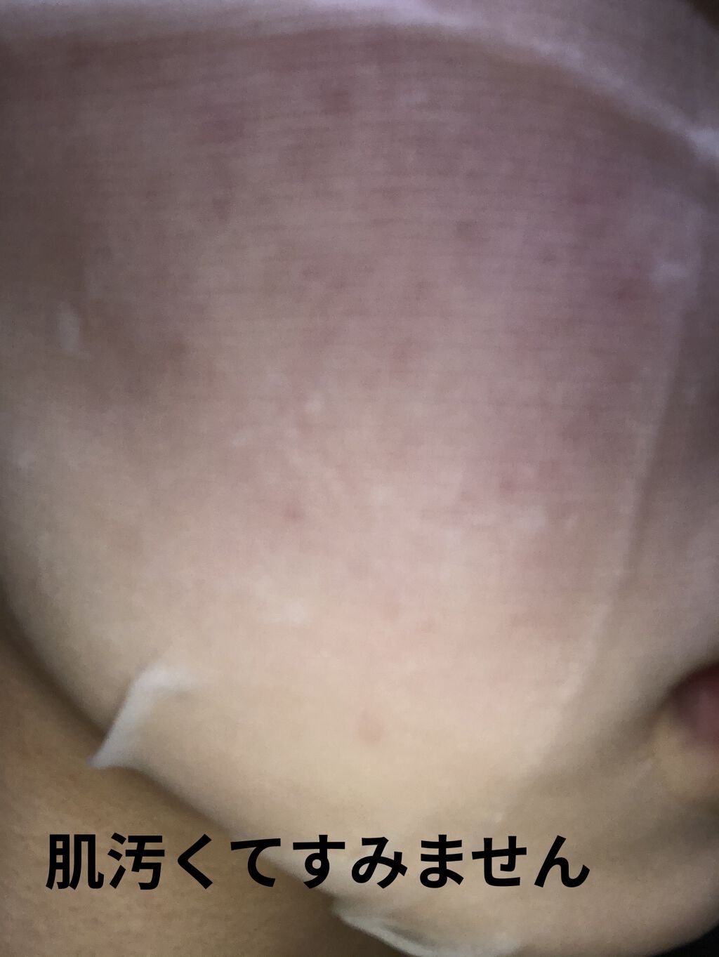 マデカソ　CICAシートマスク/A’pieu/シートマスク・パックを使ったクチコミ（3枚目）