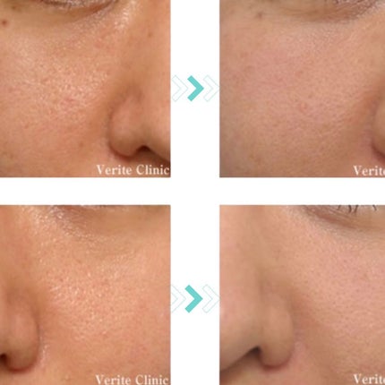 肌をうるおす保湿クリーム/肌をうるおす保湿スキンケア/フェイスクリームを使ったクチコミ(1枚目)