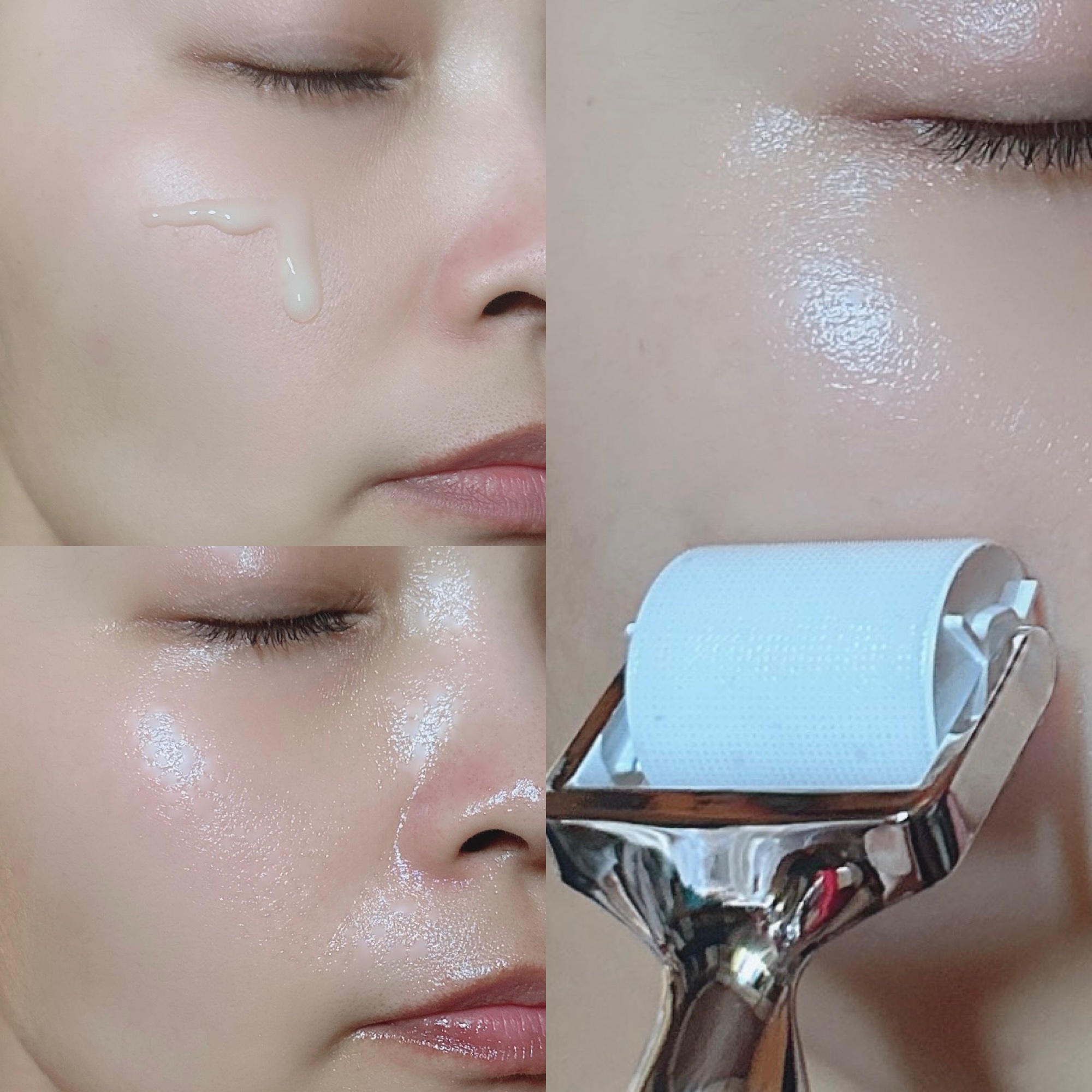 ダーマトックスニードルショット/Easydew/その他スキンケアを使ったクチコミ（3枚目）