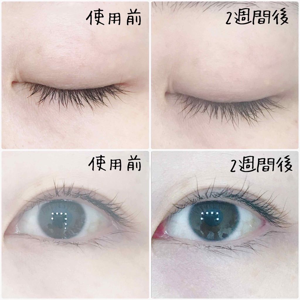 ビマージュ アイラッシュマジック/バイオテック/まつげ美容液を使ったクチコミ(4枚目)