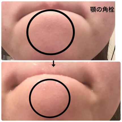 スクラビング マッド ウォッシュ/KANEBO/洗顔フォームを使ったクチコミ(4枚目)