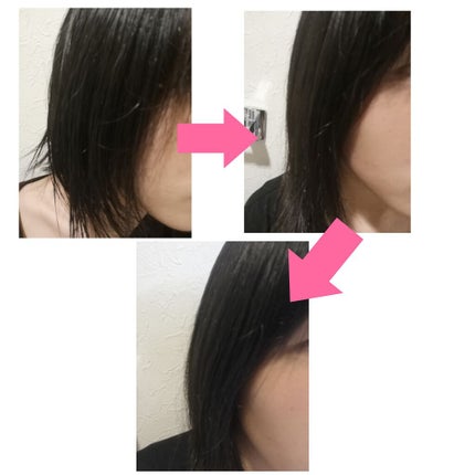 A アクネローション/NOV/化粧水を使ったクチコミ(3枚目)