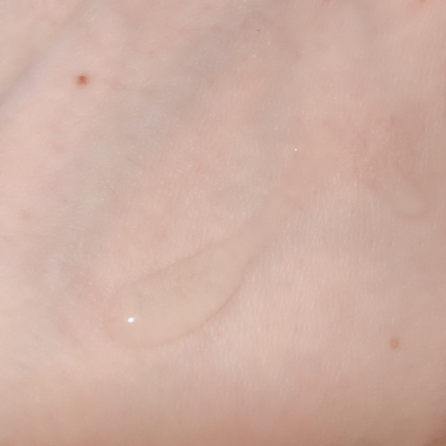 れんげ化粧水/れんげ研究所/化粧水を使ったクチコミ(3枚目)