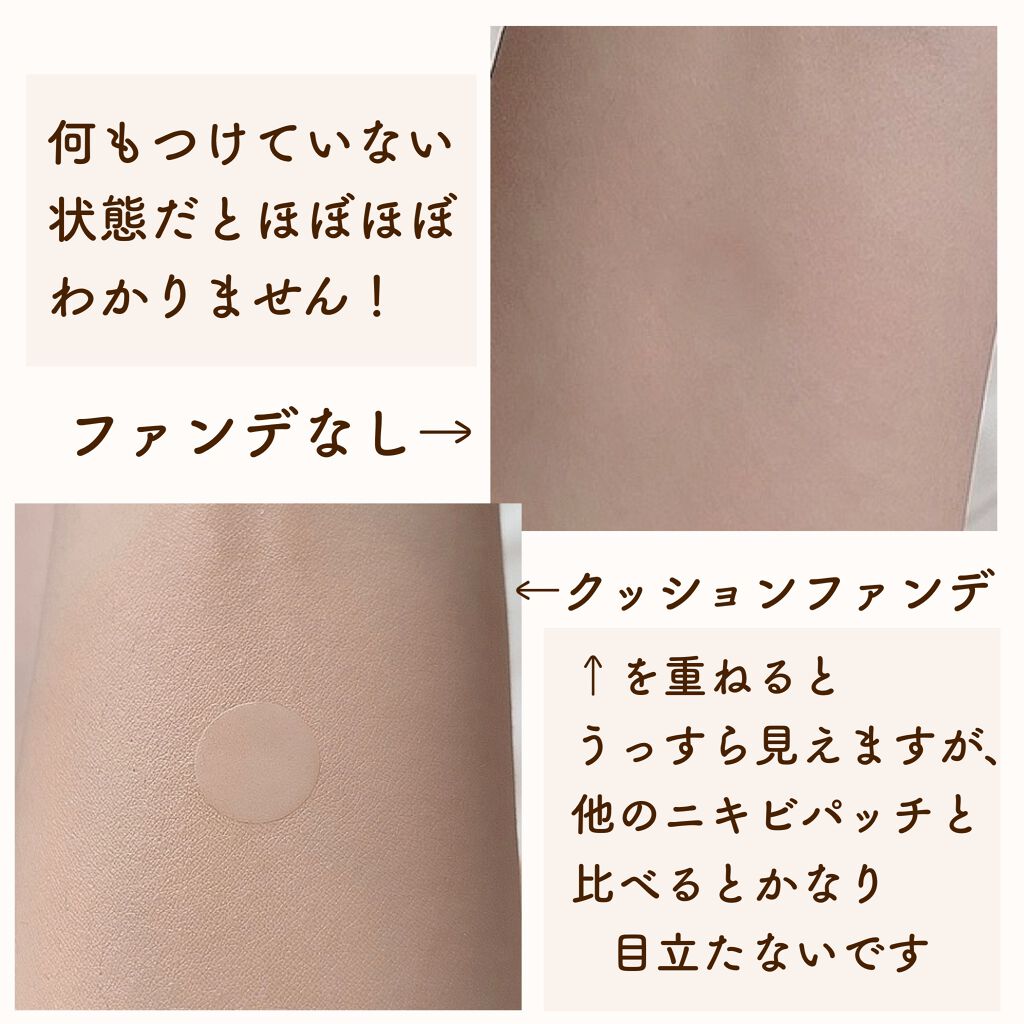 極薄透明パッチ nikipa!/金冠堂/にきびパッチを使ったクチコミ(3枚目)