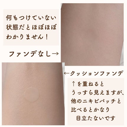 極薄透明パッチ nikipa!/金冠堂/にきびパッチを使ったクチコミ(3枚目)