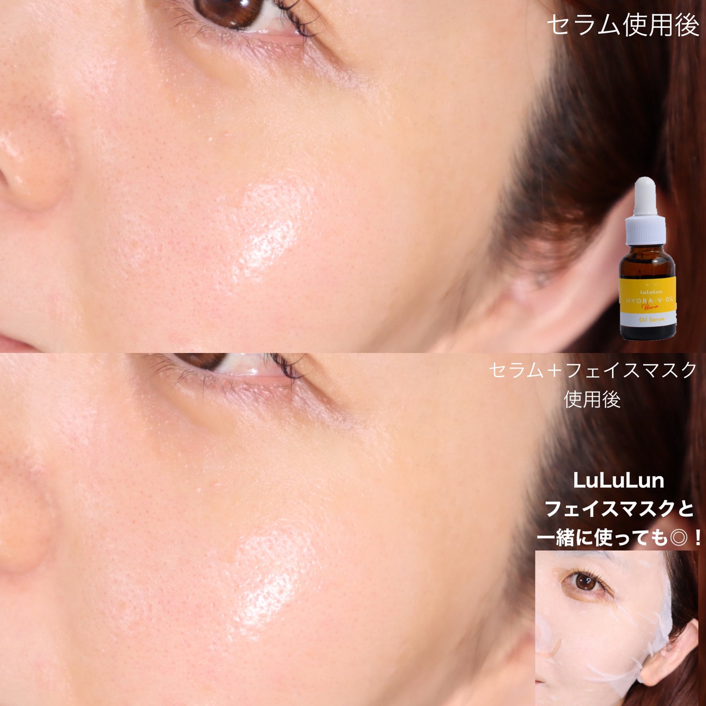 ルルルン ハイドラ V オイルセラム/ルルルン/美容液を使ったクチコミ(5枚目)