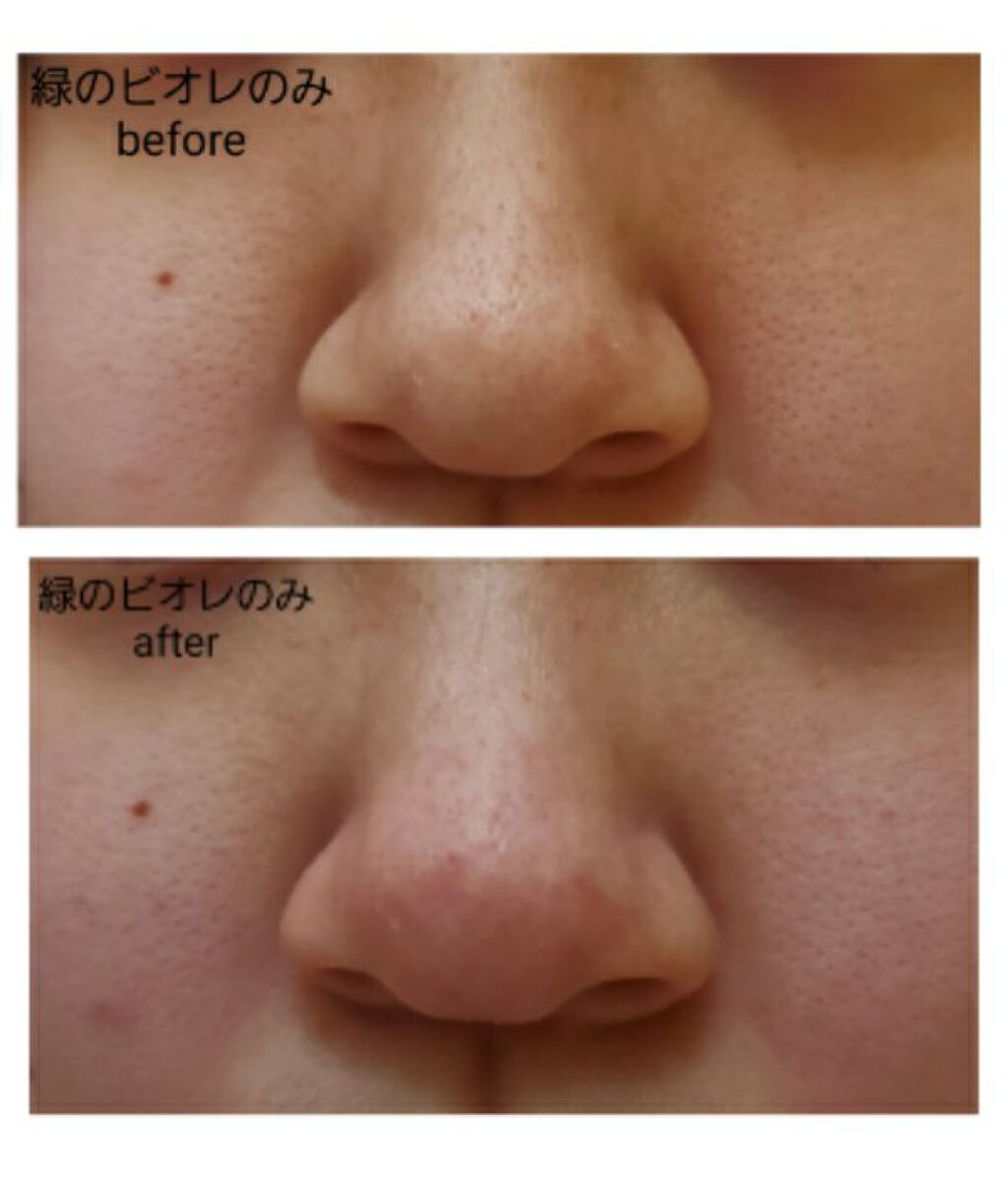 エマルジョンリムーバー 300ml/200ml/水橋保寿堂製薬/その他洗顔料を使ったクチコミ(2枚目)