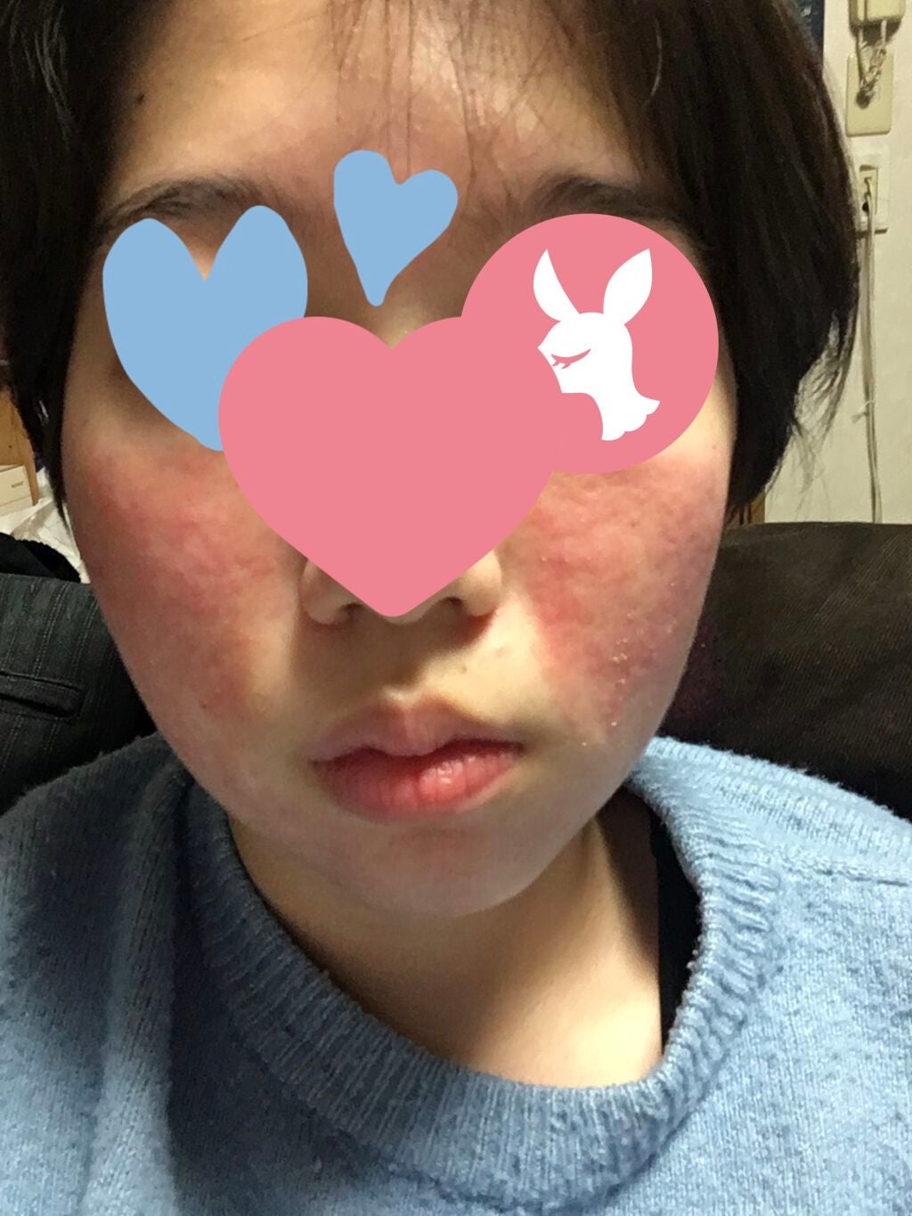 なつみ on LIPS 「今回はペビオゲルについてです。できるだけ手短に行きたいと思いま..」(2枚目)