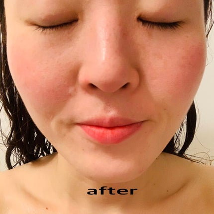 レッドパワー セラム/アイビー/美容液を使ったクチコミ(4枚目)