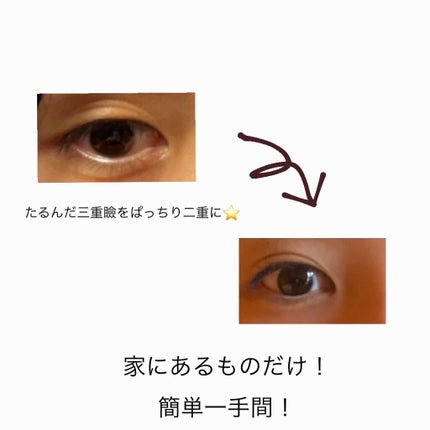 アドバンス ナイト リペア アイ SR コンプレックス/ESTEE LAUDER/アイケア・アイクリームを使ったクチコミ(1枚目)