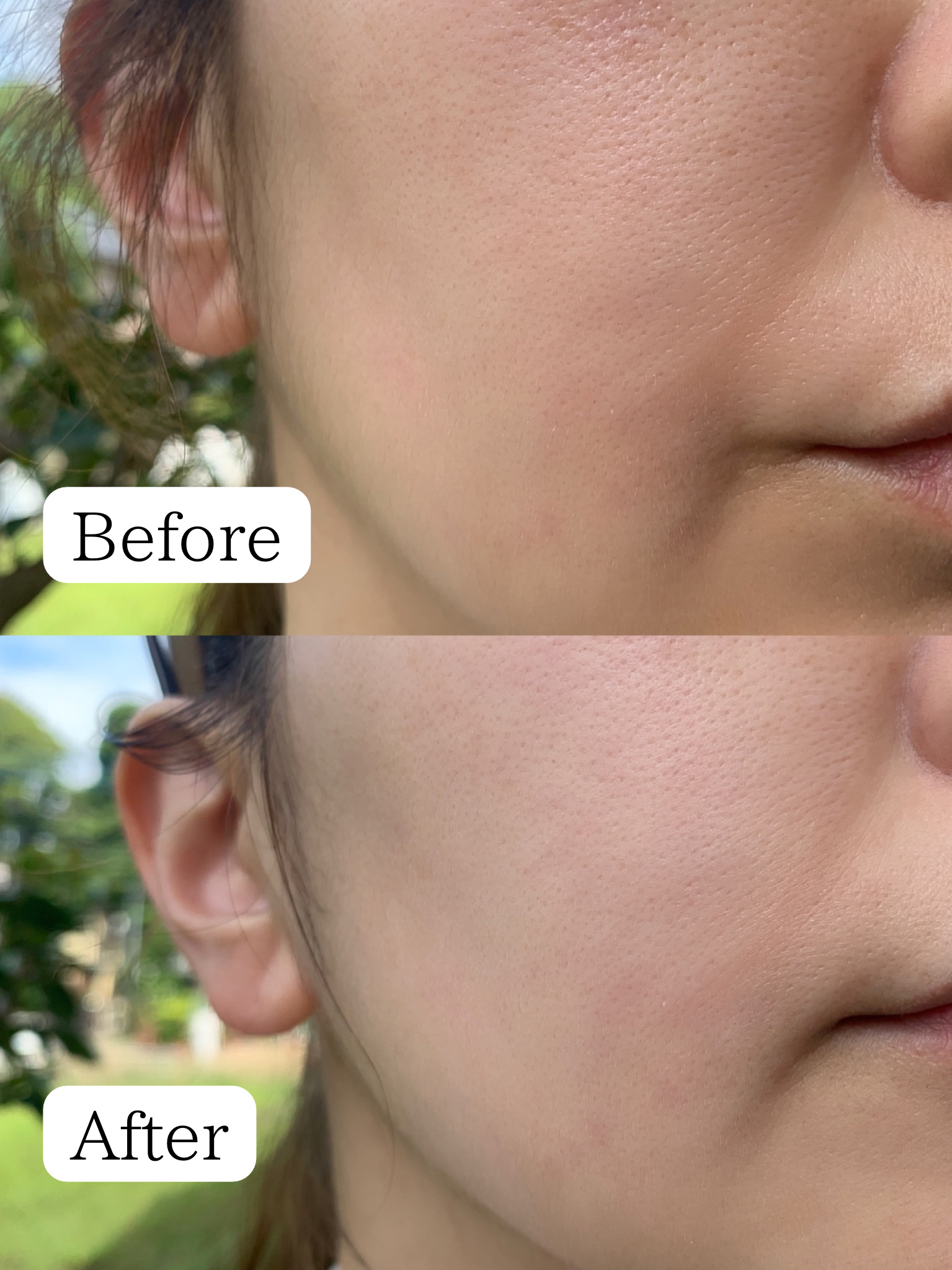 美白乃美人ピーリングジェル/ブレーンコスモス/ピーリングを使ったクチコミ（3枚目）