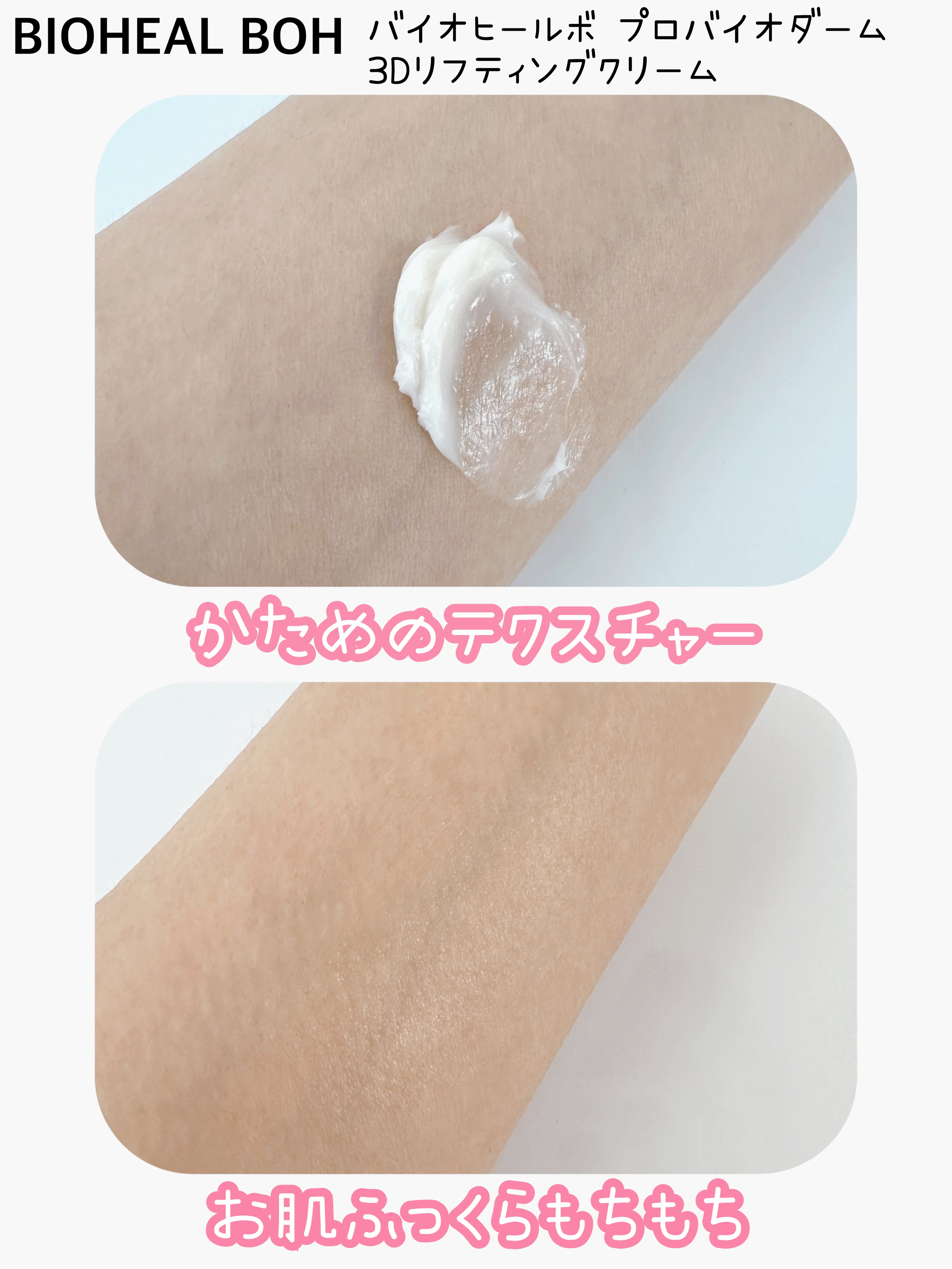 バイオヒールボ プロバイオダーム 3Dリフティングクリーム/BIOHEAL BOH/フェイスクリームを使ったクチコミ（3枚目）