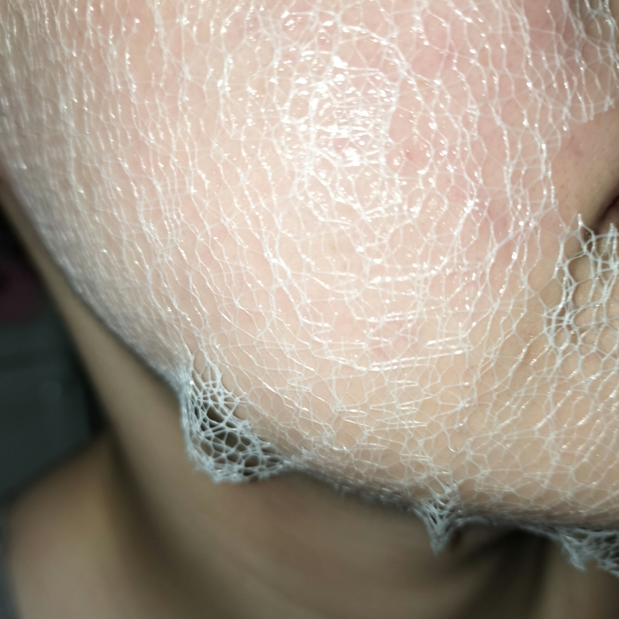 リンクルフィットマスク/MEDITHERAPY/シートマスク・パックを使ったクチコミ（3枚目）