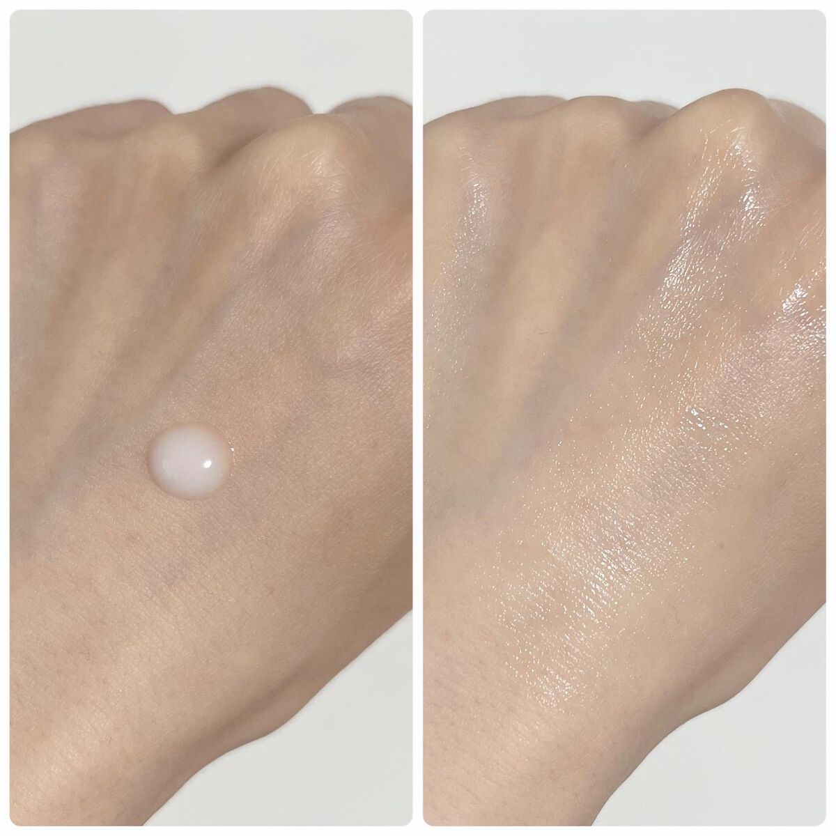 カルテHD バランスケア エマルジョン/カルテHD/乳液を使ったクチコミ（3枚目）