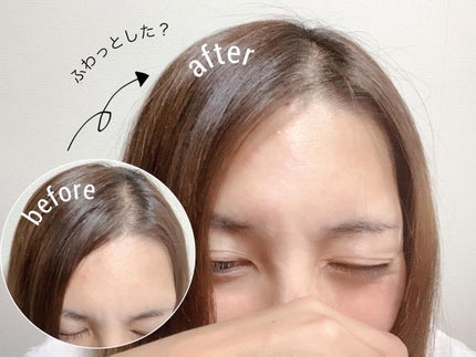 growbio/JYU-KEN/頭皮ローションを使ったクチコミ(3枚目)