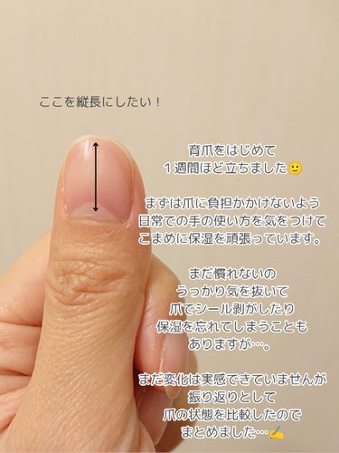 🍓emupan🍓 on LIPS 「育爪はじめて10日ほど立ちました🙂まだ爪の形の変化は実感できて..」（2枚目）