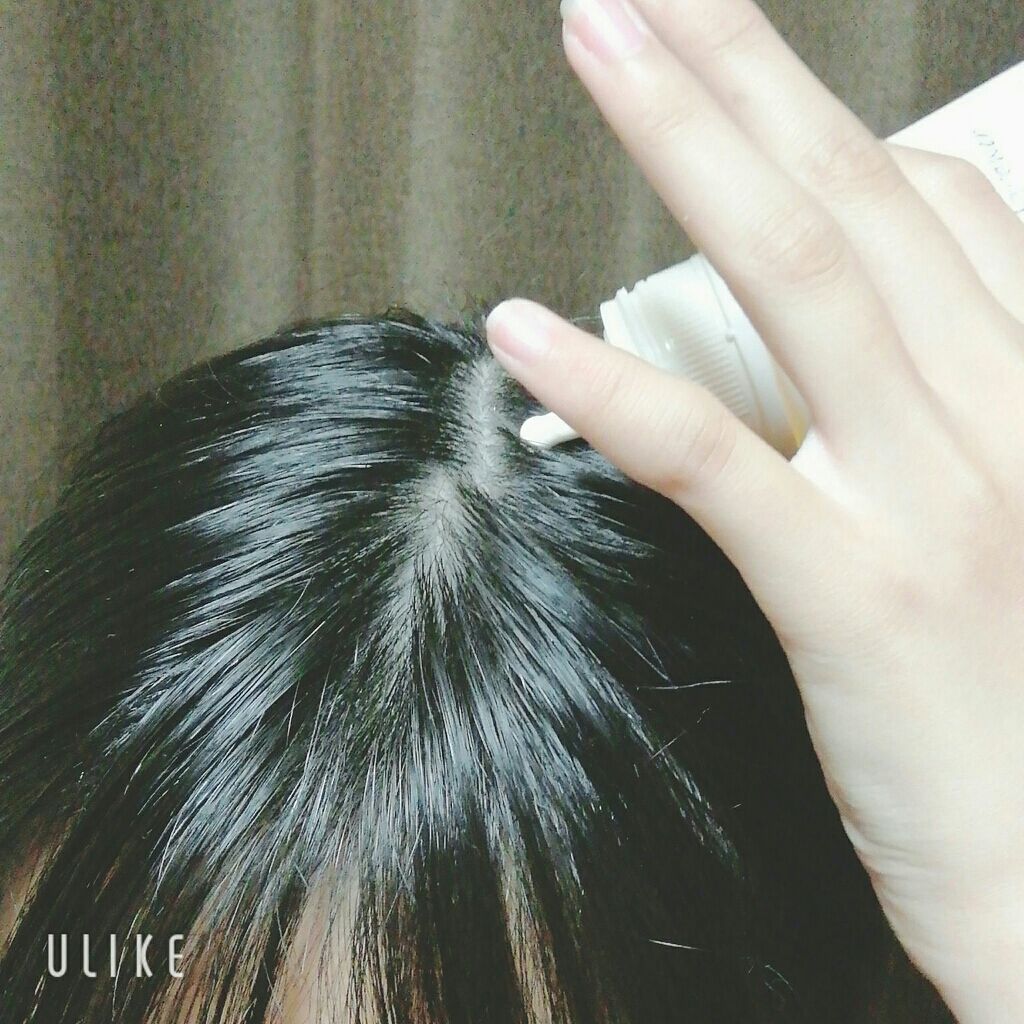 マイナチュレ 無添加育毛剤/マイナチュレ/頭皮ローションを使ったクチコミ（3枚目）