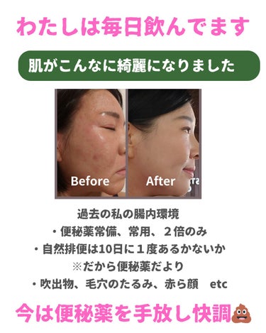 美肌カウンセラー💆綺麗のお助け相談所 on LIPS 「おなかの調子を良好にして肌も綺麗になる🍀超便秘体質だった私の救..」（2枚目）