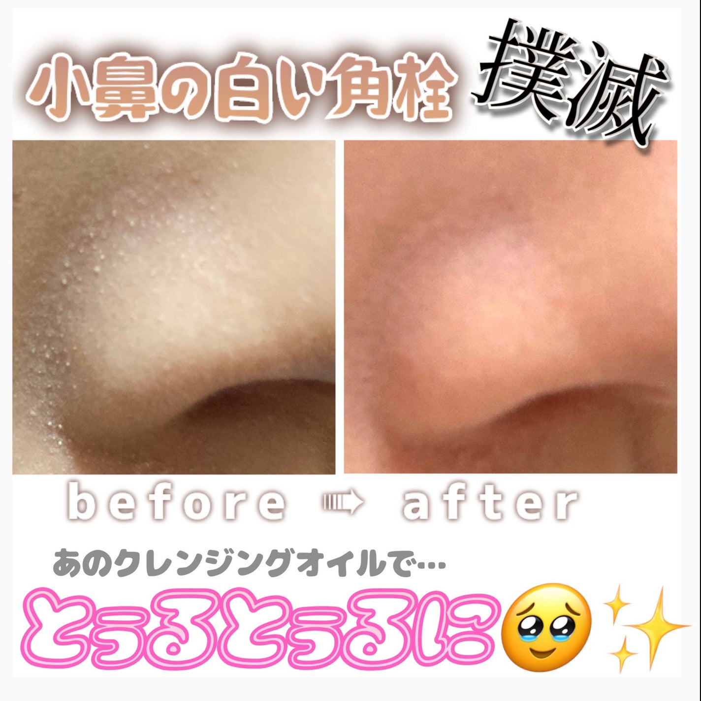 マイルドクレンジング オイル/ファンケル/オイルクレンジングを使ったクチコミ(1枚目)