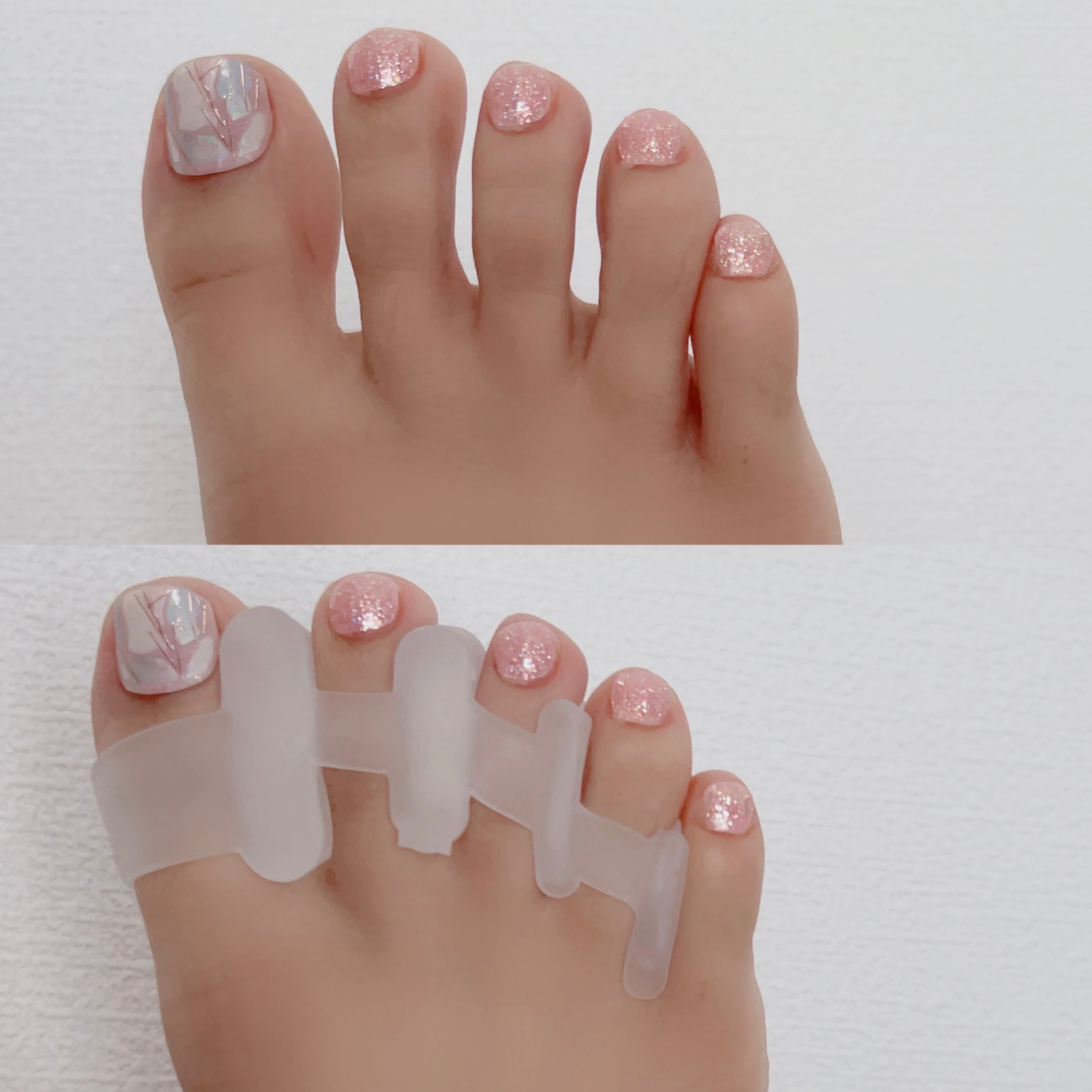 足指サポーター/potegar/その他を使ったクチコミ（3枚目）