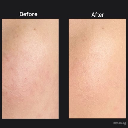 ãªãŒã«ã¢ã¯ãŒãº ãªããã/YVES SAINT LAURENT BEAUTE/ãªããããã¡ã³ããŒã·ã§ã³ã䜿ã£ãã¯ãã³ãïŒ9æç®ïŒ