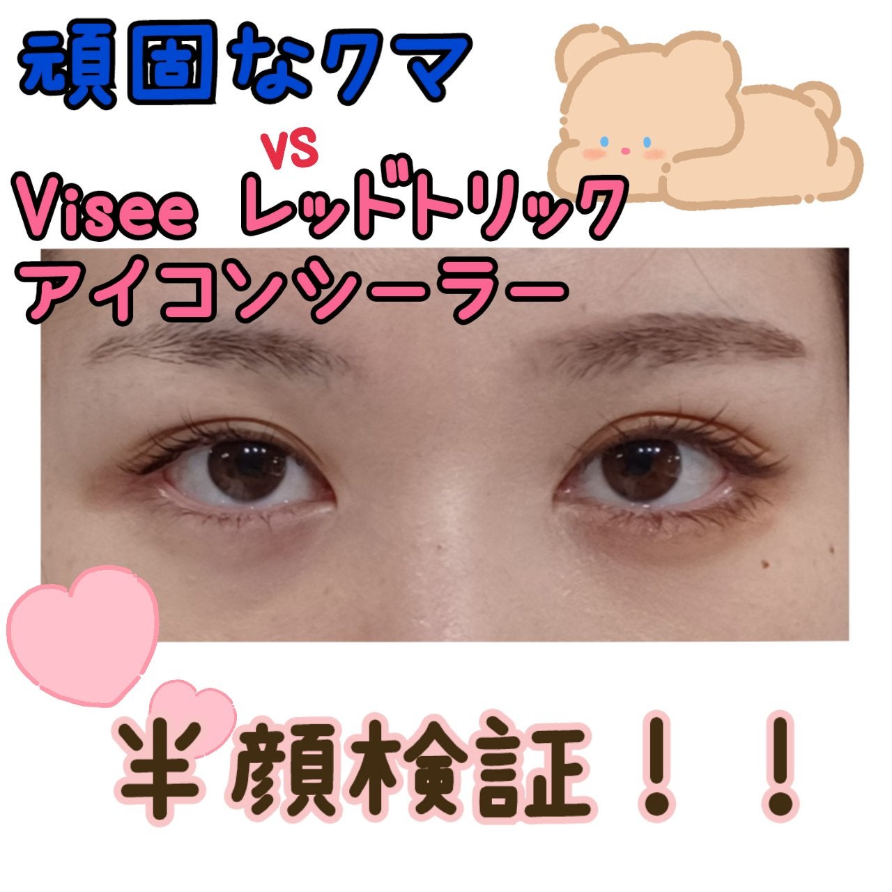 リシェ レッドトリック アイコンシーラー/Visée/パレットコンシーラーを使ったクチコミ(1枚目)