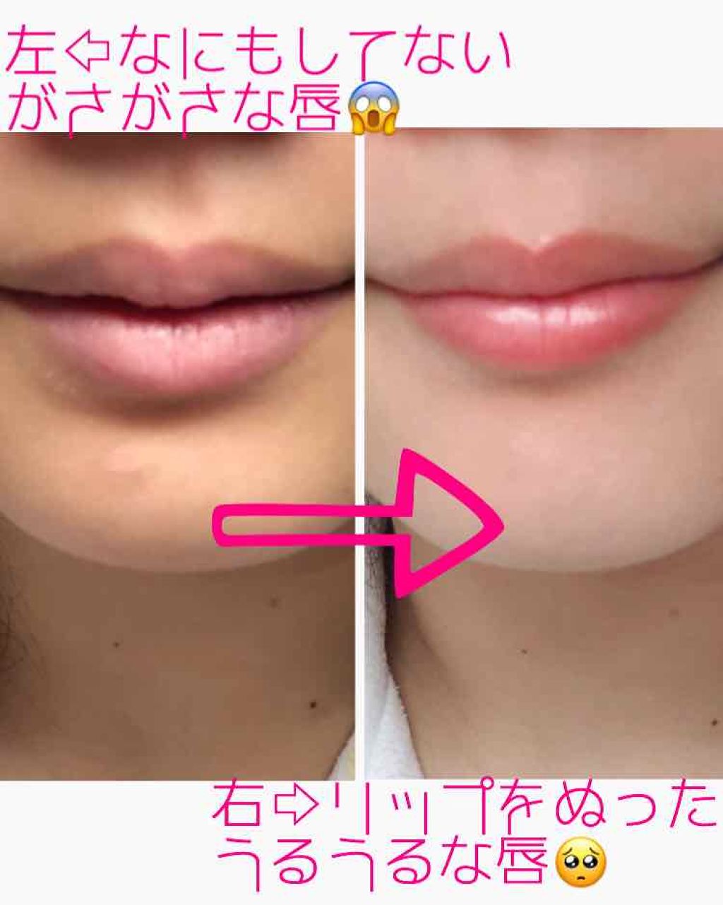 リップケア クリーム/キュレル/リップクリームを使ったクチコミ(3枚目)