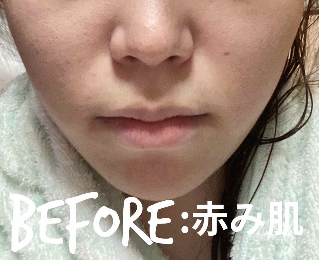 キャロットカロテン カーミングウォーターパッド/SKINFOOD/トナーパッドを使ったクチコミ(3枚目)