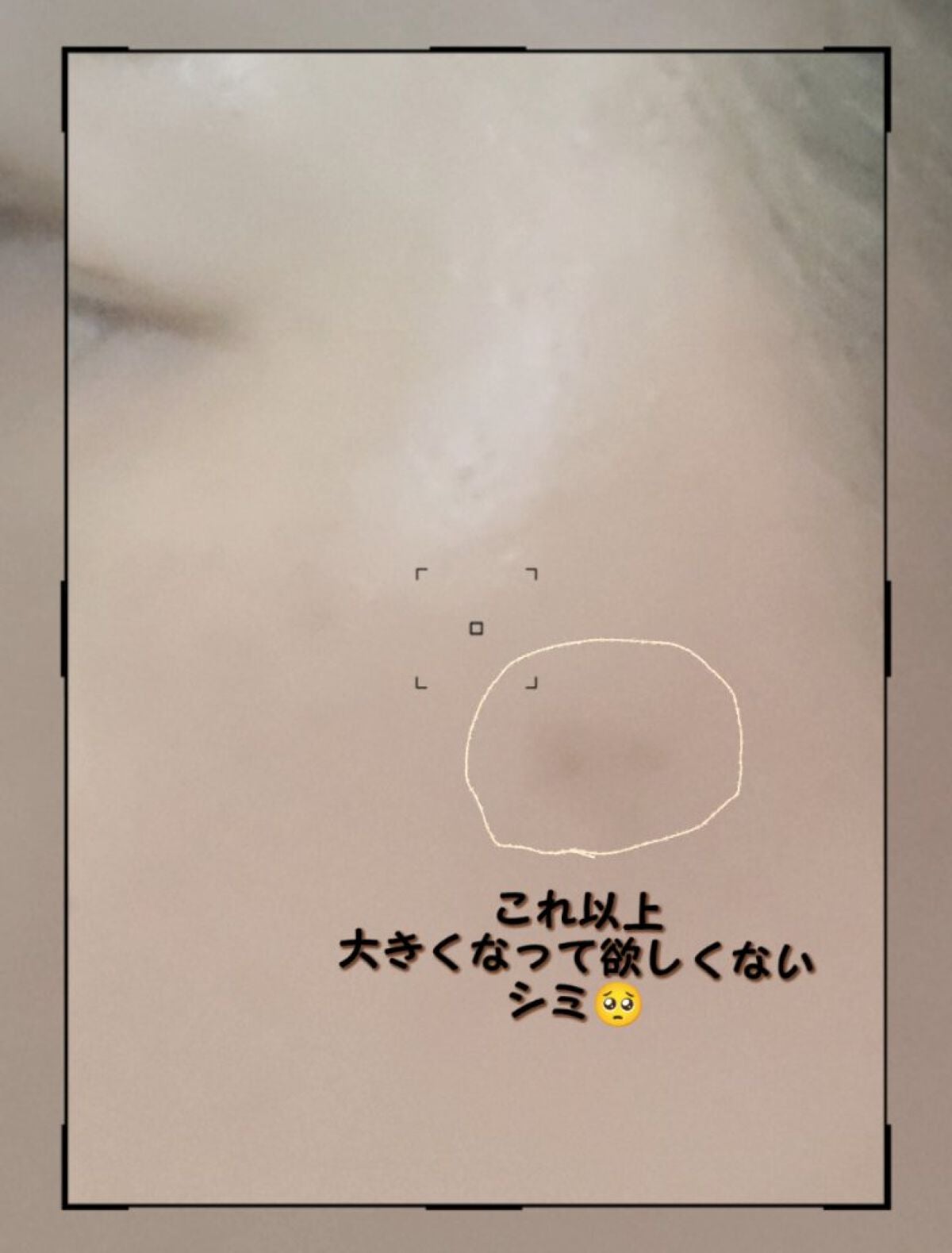 メラノショット W/ONE BY KOSE/美容液を使ったクチコミ(3枚目)