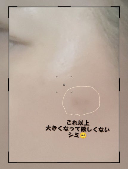 メラノショット W/ONE BY KOSE/美容液を使ったクチコミ(3枚目)