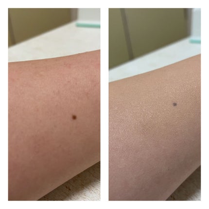 ドラマティックジェリーコンパクト/マキアージュ/クッションファンデーションを使ったクチコミ(4枚目)