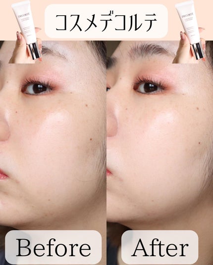 miku♡元美容部員 on LIPS 「美容ライターmikuでございます💛今回は!グロウライザーがベ..」(7枚目)