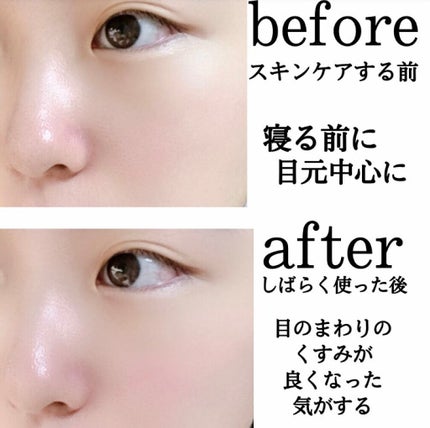 ハイドロナイト/ブレーンコスモス/フェイスクリームを使ったクチコミ(4枚目)